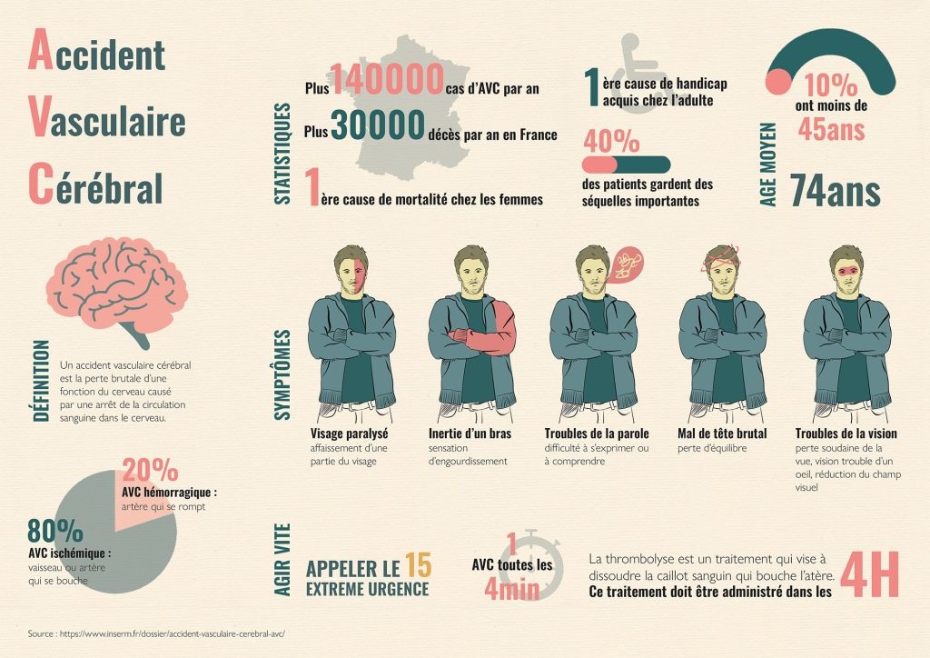 Infographie sur les AVC conçue par Studio Yblou pour sensibiliser et informer le grand public